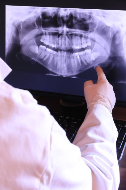 Best Emergency Root Canal Treatment in Wayland, IA
